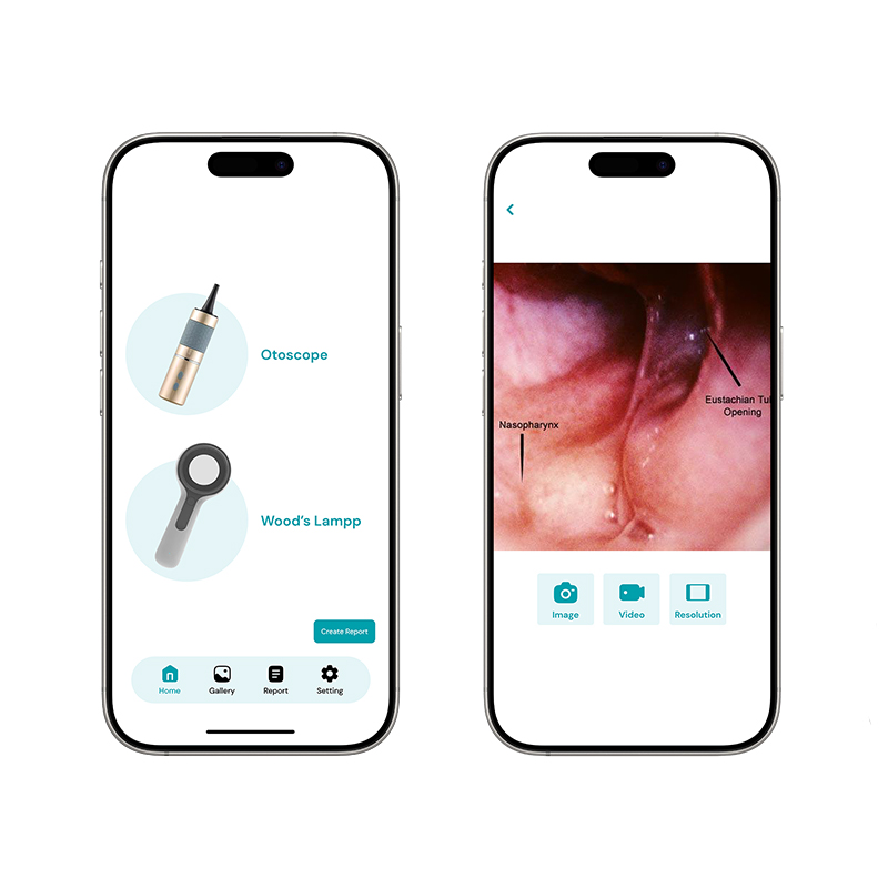 Veterinary Wireless Video Otoscope